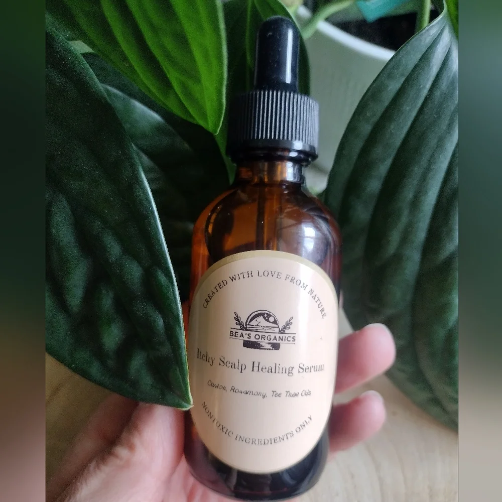 Itchy Scalp Healing Serum, dandruff, dry skin, hair loss